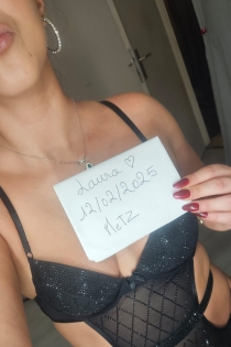 Laura, 26 éves, Metz / Franciaország Escorts – 5