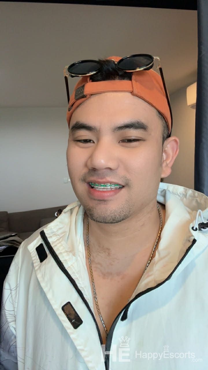 เบนโจ อายุ 30 ปี - 1
