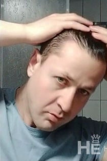 Análny otrok pre W + M, vek 40